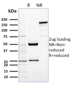 Data from SDS-PAGE analysis of Anti-AKT1 antibody (Clone AKT1/2552). Reducing lane (R) shows heavy and light chain fragments. NR lane shows intact antibody with expected MW of approximately 150 kDa. The data are consistent with a high purity, intact mAb.